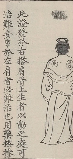 插图