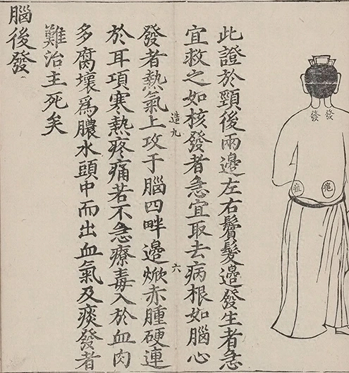 插图