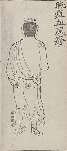 插图