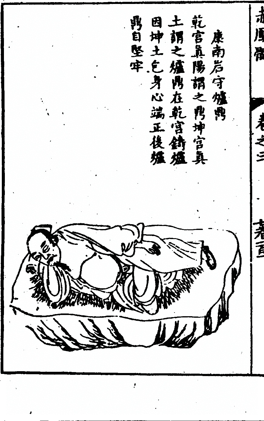 第 148 页